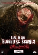 Best Of The Bloodiest Brawls: Scars And Stitches